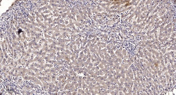 Neuro D rabbit pAb Antibody