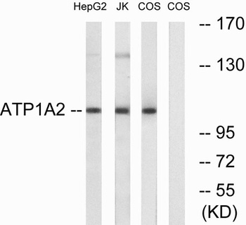 Na+/K+-ATPase α2 rabbit pAb Antibody