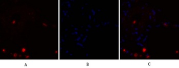 NFκB-p105/p50 rabbit pAb Antibody