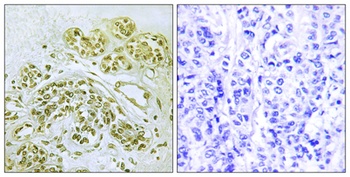 IκB-α (phospho Tyr42) rabbit pAb