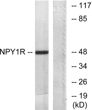 NPY1-R rabbit pAb Antibody