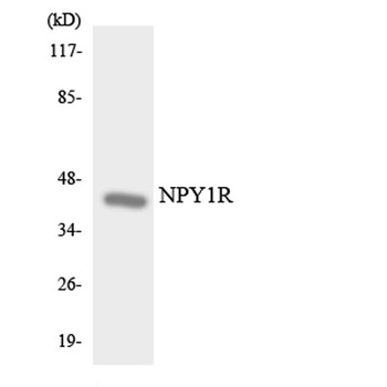 NPY1-R rabbit pAb Antibody