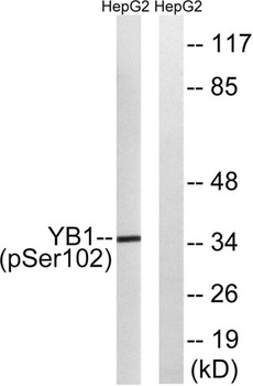 YB-1 (phospho Ser102) rabbit pAb Antibody