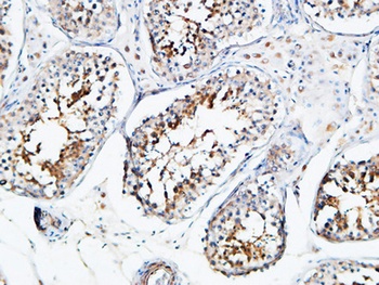 YB-1 rabbit pAb Antibody