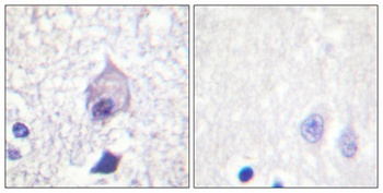 Trk A rabbit pAb Antibody