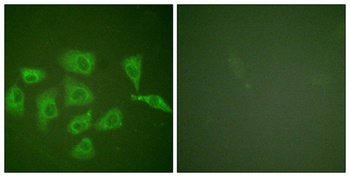 Trk A rabbit pAb Antibody