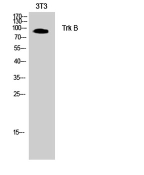 Trk B rabbit pAb Antibody