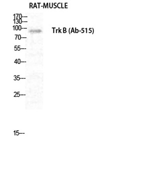 Trk B rabbit pAb Antibody