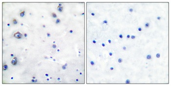 Trk B rabbit pAb Antibody