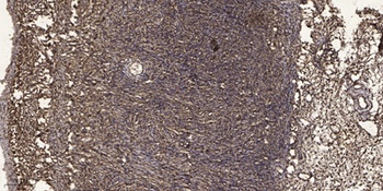 KOR-1 rabbit pAb Antibody