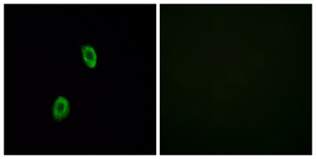 Olfactory receptor 1D2 rabbit pAb Antibody