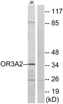 Olfactory receptor 3A2 rabbit pAb Antibody