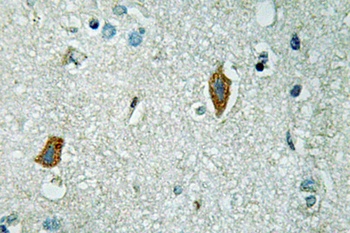 PAI-2 rabbit pAb Antibody