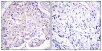 PAKα (phospho Thr212) rabbit pAb