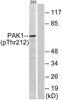 PAKα (phospho Thr212) rabbit pAb