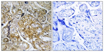 PAKα (phospho Ser199) rabbit pAb