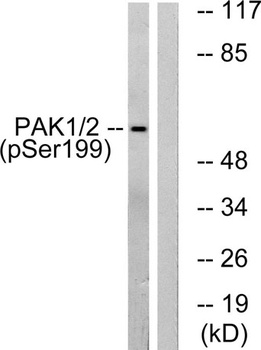 PAKα (phospho Ser199) rabbit pAb