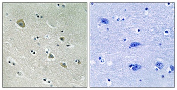 PAKα (phospho Ser204) rabbit pAb