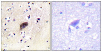 PAKα/β/γ (phospho Ser144/141/139) rabbit pAb