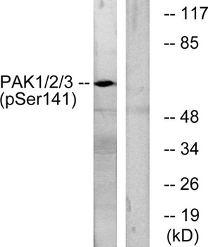 PAKα/β/γ (phospho Ser144/141/139) rabbit pAb