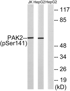 PAKγ (phospho Ser141) rabbit pAb Antibody
