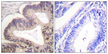 PAKγ (phospho Ser20) rabbit pAb