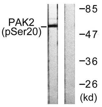 PAKγ (phospho Ser20) rabbit pAb