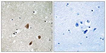 PAKβ (phospho Ser154) rabbit pAb