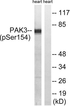 PAKβ (phospho Ser154) rabbit pAb