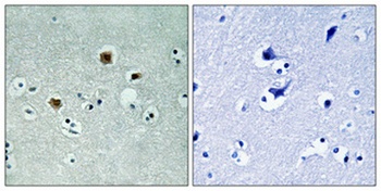 PAKβ rabbit pAb Antibody
