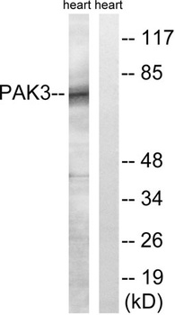 PAKβ rabbit pAb Antibody