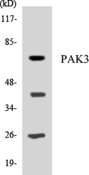 PAKβ rabbit pAb Antibody