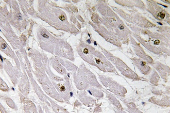 Pax-1 rabbit pAb Antibody