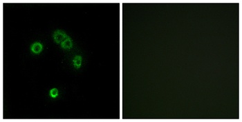 T2R13 rabbit pAb Antibody