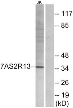 T2R13 rabbit pAb Antibody