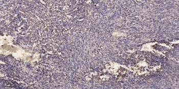 T2R13 rabbit pAb Antibody