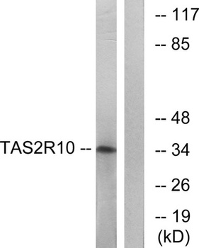 T2R10 rabbit pAb Antibody