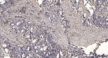 T2R10 rabbit pAb Antibody