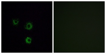 T2R14 rabbit pAb Antibody