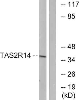 T2R14 rabbit pAb Antibody