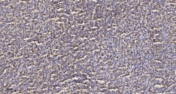 T2R14 rabbit pAb Antibody