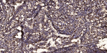 Sclerostin rabbit pAb Antibody