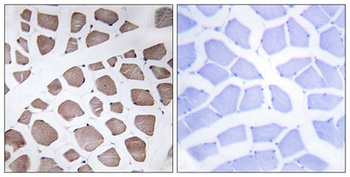 MRP-S18C rabbit pAb Antibody