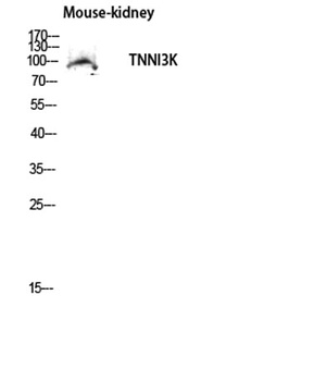 TNNI3K rabbit pAb Antibody