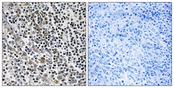 MRP-L51 rabbit pAb Antibody
