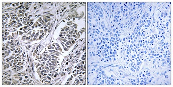 ATP5D rabbit pAb Antibody