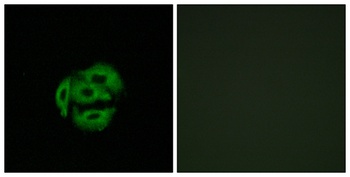 CYP39A1 rabbit pAb Antibody