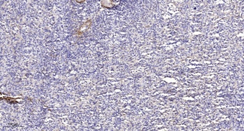 CYP39A1 rabbit pAb Antibody