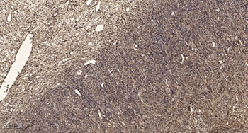 RNF138 rabbit pAb Antibody