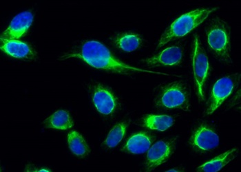 PDGF-B rabbit pAb Antibody